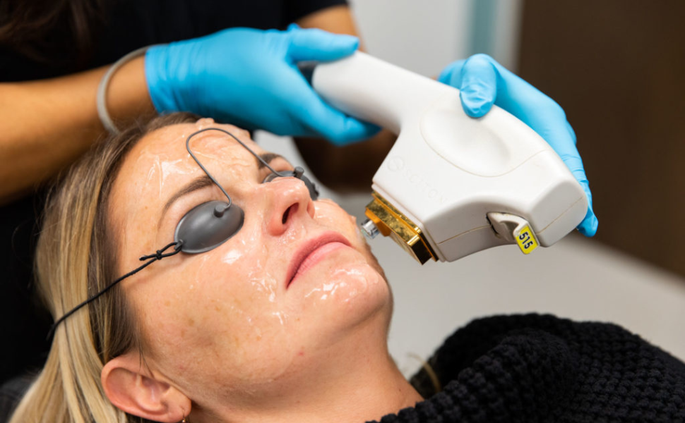 Broadband Light Therapy facial treatment at Belle Âme Med Spa in Oklahoma City.